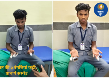 बालोद ITI हादसा: ट्रेनिंग के नाम पर काम कराते वक्त छात्र की 5 उंगलियां कटीं, विरोध के बाद प्राचार्य सस्पेंड