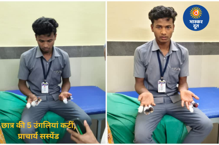 बालोद ITI हादसा: ट्रेनिंग के नाम पर काम कराते वक्त छात्र की 5 उंगलियां कटीं, विरोध के बाद प्राचार्य सस्पेंड